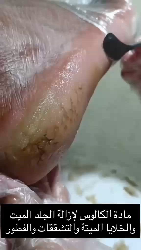 للحجز والاستفسار خاص


**إذا كنت صاحب هذا الإعلان وتريد حذفه لأي سبب، رجاءا أرسل رسالة إلى الدعم الفني**