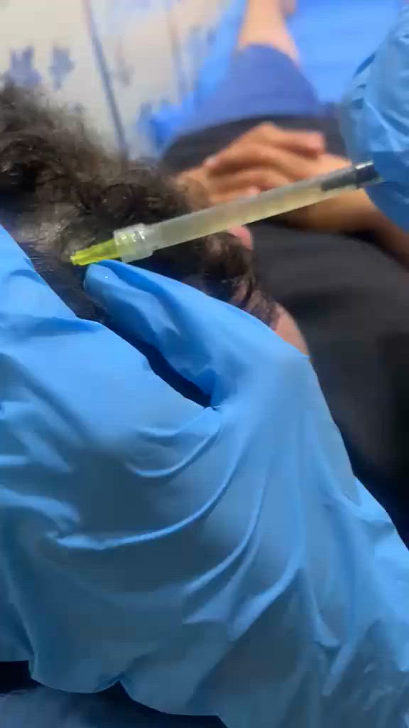 حقن بلازما شعر وبلازما وجه
بلازما عاديه ١٥ الف
بلازما مفعلة ٢٥ الف
بلازما ماتركس ٤٠ الف
الاعظمية شارع ٢٠ مقابيل حجامة ابو عمر فرع بيت شقوقي
للحجز والاستفسار ***********
