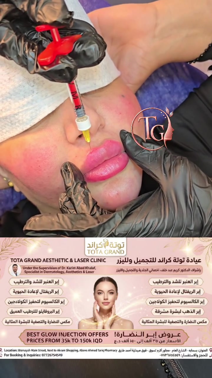 اهلا بكم بعياده تــდــــوته كراند🥰
 والدكتور كريم عبد خلف🥼🩺 اخصائي الجلديه والتجميل والليزر بورد امريكي وبريطاني بالجراحه التجميليه 
________________________________________________
متواجدين على مدار الاسبوع عل حجز فقط 
العنوان بسمايه الشارع العام مجاور اكرم تسوق فوق صيدليه احمد طارق للحجز والاستفسار ☎️☎️***********
