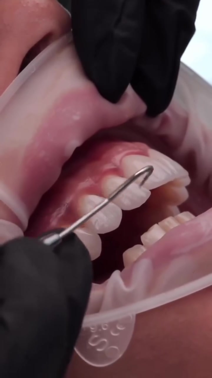 "🦷 أسنان صحية وابتسامة مشرقة... والدفع بـ "كي كارد"! 💳

ما في شي أحلى من ابتسامة جميلة... إلا إذا كان الدفع عليها سهل وآمن! ✅😉😉

في مراكز الشركة الطبية العالمية ، نوفر لك أحدث تقنيات طب الأسنان، وأسهل طرق الدفع.

✅ تقويم الأسنان ✅ تبييض الأسنان ✅ ابتسامة هوليوود
زراعة أسنان 
وحشوات وكتير من الخدمات 

متواجدين داخل المركز طيلة أيام الأسبوع لخدمتكم 

  #عيادة_اسنان #طب_اسنان #كي_كارد #KeeCard #دفع_الكتروني تقويم_اسنان تبييض_الاسنان زراعة_الاسنان ابتسامة جمال صحة

العنوان : طويريج _الشارع العام_مجاور نقابة المعلمين _مقابل المكتبة العامة _مجمع الحارث الطابق الثاني 

رقم الهاتف ***********
  ***********
