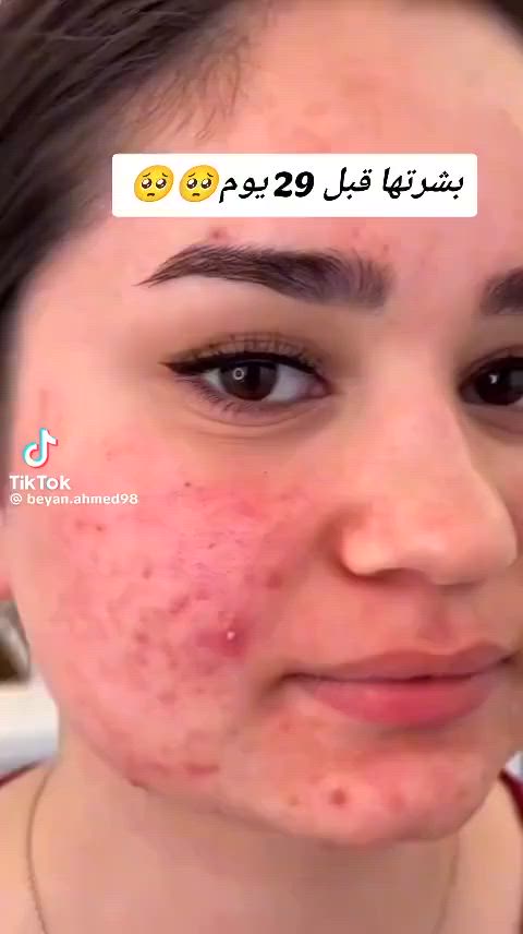 عندج كلف عندك حبوب بشرتك لكل انواع البشره وجميع المشاكل صابونه جانوزي العضويه من شركة DXNالعالميه الحل الامثل لجميع المشاكل مجربه ومضمونه


**إذا كنت صاحب هذا الإعلان وتريد حذفه لأي سبب، رجاءا أرسل رسالة إلى الدعم الفني**