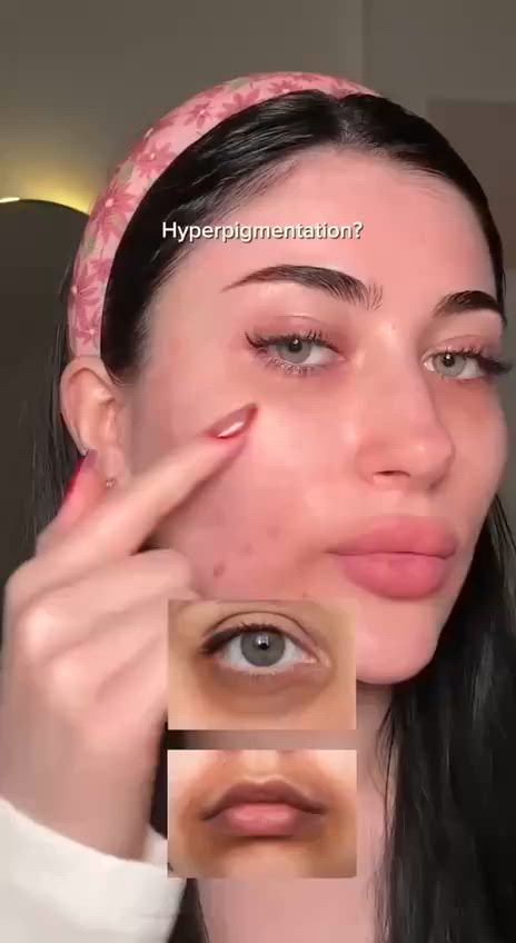شوفو شنو توفر عندنا 😍😍

Arencia – Face & Eye Cream Moisturizer
✨ Vitamin C Booster Shot ✨
كريم خفيف وعملي يخدم كـ Booster بفيتامين C، ينفع للوجه وتحت العين في نفس الوقت 👌
💛 تركيبة ذكية تعطيك إشراقة وترطيب بدون ما تحسي بثقل أو دهنية

يحتوي على :
✔️ Vitamin C Complex (5%) → إشراقة واضحة + توحيد لون البشرة
✔️ Glutathione → يساعد على التخفيف من التصبغات ويزيد النضارة
✔️ مرطّبات خفيفة → ترطيب مريح بدون ما يسد المسام

الفوائد:
✨ يعطي إشراقة من أول استعمال
🎯 يساعد تدريجياً على تقليل البقع والتصبغات
👁️ يخفف مظهر التعب والهالات تحت العين
💧 يرطّب البشرة بدون إحساس دهني

😍 مناسب للاستعمال اليومي، خصوصاً لو تبي نتيجة ناعمة وبشرة حيوية
المنشأ كوريا الأصلي 🇰🇷


**إذا كنت صاحب هذا الإعلان وتريد حذفه لأي سبب، رجاءا أرسل رسالة إلى الدعم الفني**
