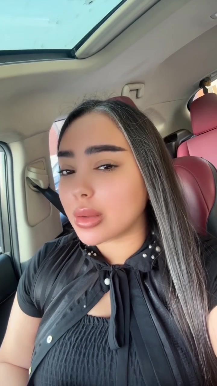 إذا أول حل انعرض عليك هو: “نزرعلك من اللحية أو الجسم”… اسأل نفسك ليش؟

لأن نجاح زراعة الشعر مو بعدد البصيلات اللي يقتطفوها… النجاح يبدأ من قوة المنطقة المانحة في فروة الرأس.

المراكز اللي تعتمد بشكل أساسي على شعر اللحية أو الجسم بكل حالة، غالبًا تتجاهل أهم خطوة: التقييم الصحيح.

شعر اللحية أو الجسم إله استخدامات محددة وبحالات خاصة، مو حتى يصير هو الأساس بكل عملية.

قبل لا تنجذب لأي إعلان… شوف منين راح يزرعونك، لأن المصدر هو اللي يحدد جودة النتيجة.

بمركز المنصور، ما نوعدك بأي كلام… نختار الحل اللي يخدم نتيجتك على المدى البعيد، مو مجرد إعلان يجذبك.

للاستفسار اكثر الاتصال ع الرقم
***********

او زورونا بموقع العياده
بغداد المنصور شارع الرواد مقابل مرطبات مشمشه
