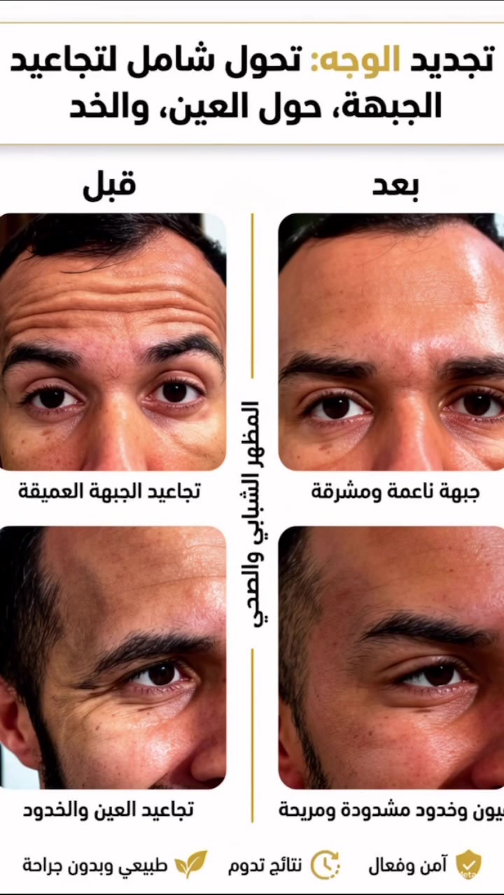 نتيجه حقن البوتوكس لتجاعيد مابين الحاجب والجبهه وماحول العين 💉💞

الشغل الصح✅بالمكان الصح ✅
❤️❤️❤️❤️❤️❤️❤️❤️❤️❤️

مجمع ترف كلينك الطبي.

العنوان مدينة الصدر خلف سوق العورة 
قطاع ٧١ مقابل ملعب قطاع ٣٦
للحجز والاستفسار مراسلة الصفحة أو الاتصال على الأرقام التالية ☎️ ‭***********‬

#مدينةالصدر
#اسنان
#تركيب
#حشوة
