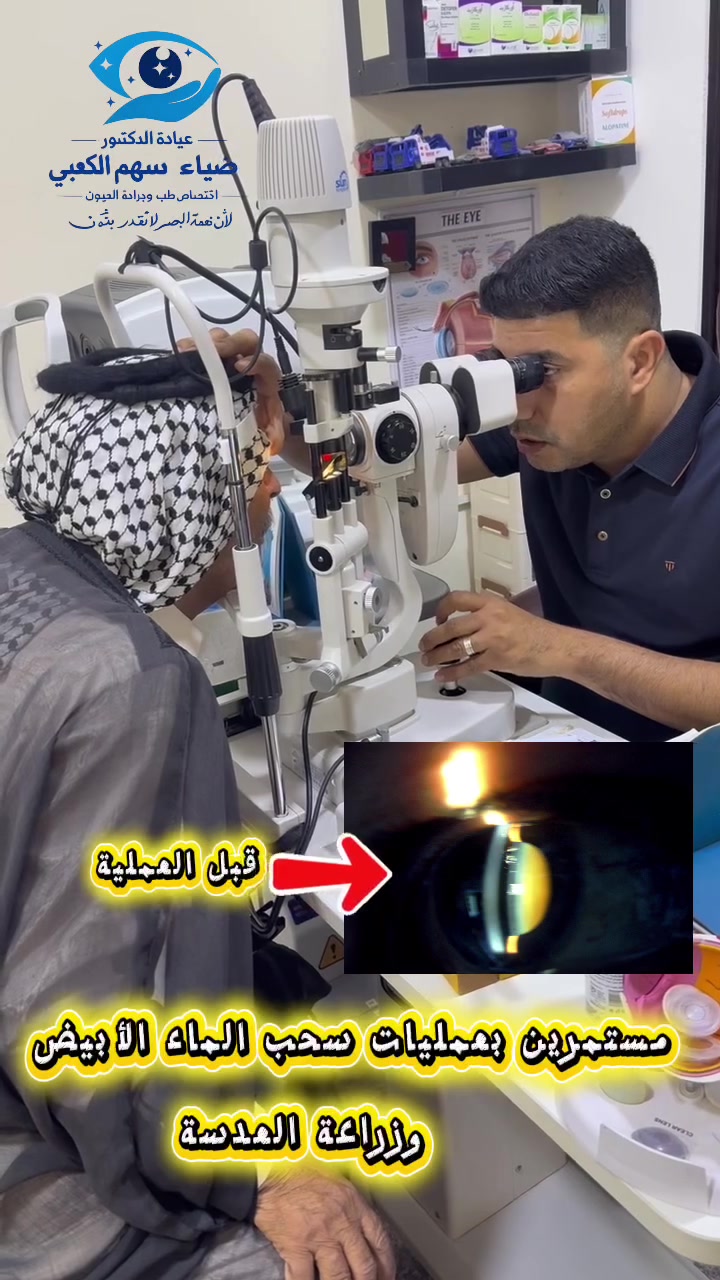 نمنحكم وضوح الرؤية بأحدث التقنيات العالمية في جراحة الماء الأبيض وزراعة العدسات."
مستمرون بإجراء عمليات سحب الماء الأبيض وزراعة العدسات بأحدث التقنيات العالمية... لأن نعمة البصر تستحق الأفضل."

عيادة الدكتور ضياء سهم الكعبي
أخصائي طب وجراحة العيون 
شهاده البورد العراقي في طب وجراحة العيون
زميل المجلس العراقي لطب وجراحة العيون
زميل المجلس العالمي لطب وجراحة العيون(لندن)

📍 العنوان: [الديوانية/ قضاء عفك/ مجمع الكوثر الطبي / مجاور عيادة الدكتور أحمد جواد البرقعاوي]

⏰ أوقات العمل: [متواجدين طيلة أيام الأسبوع  من الساعه الثالثة الى الساعة الثامنه مساءاً]

📞 للحجز والاستفسار: [***********]

✨ عينك أمانة... بين أيدٍ أمينة

