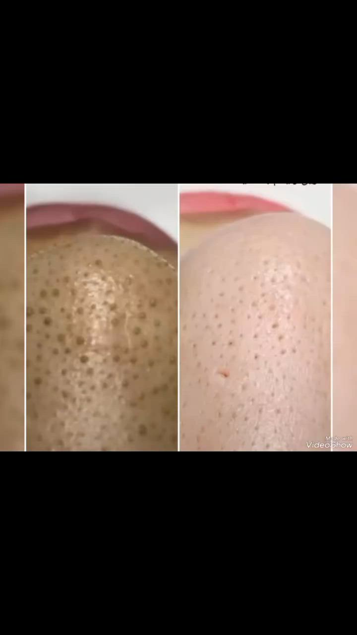 تنظيف البشرة  حاليا تخفيظات مستمره ب20
هو إجراء تجميلي وصحي يهدف إلى إزالة الأوساخ،
 الدهون المتراكمة، والجلد الميت. يساعد في فتح المسام المغلقة، تنشيط الدورة الدموية، وتأخير علامات الشيخوخة
حالياً تخفيظات مستمره للحجز خاص ام العصافير


**إذا كنت صاحب هذا الإعلان وتريد حذفه لأي سبب، رجاءا أرسل رسالة إلى الدعم الفني**