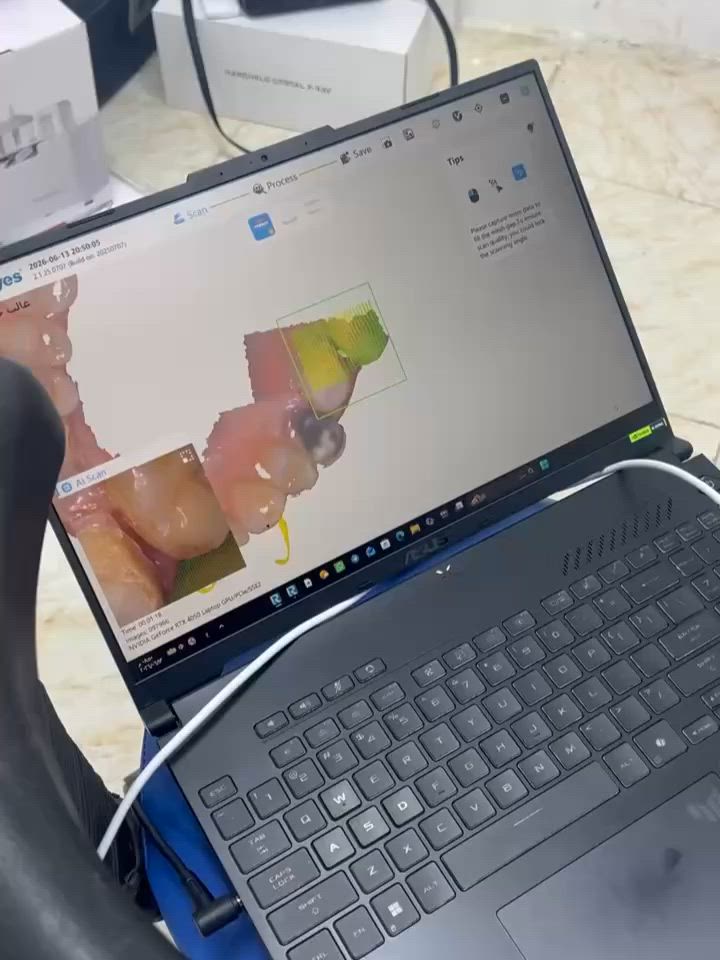 ⁨ :

✨ عيادة الجمال لطب وتجميل الأسنان ✨
📍 العنوان: جزيرة بغداد السياحية – شارع الفحامة

ابتسامة فخمة تبدي من عدنا 😍
نقدم أفضل أنواع التغليفات بأحدث التقنيات:

🦷 زركون (Zircon)
متانة عالية + شكل طبيعي

🦷 إيماكس (E.max)
جمال وشفافية تحاكي الأسنان الأصلية
 (ابتسامة هوليود بدون برد)

💎 مواد أصلية 100%
💎 شغل دقيق ونتائج مضمونة
💎 ابتسامة تخليك واثق بكل وقت

📞 للحجز والاستفسار:
***********
***********⁩
