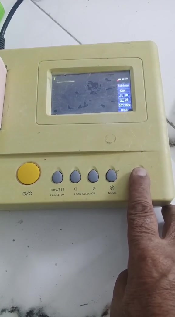 جهاز تخطيط قلب بي الرولة تشكل ما يطبع كما موضح بالفيديو للبيع جسر ديالى ***********
