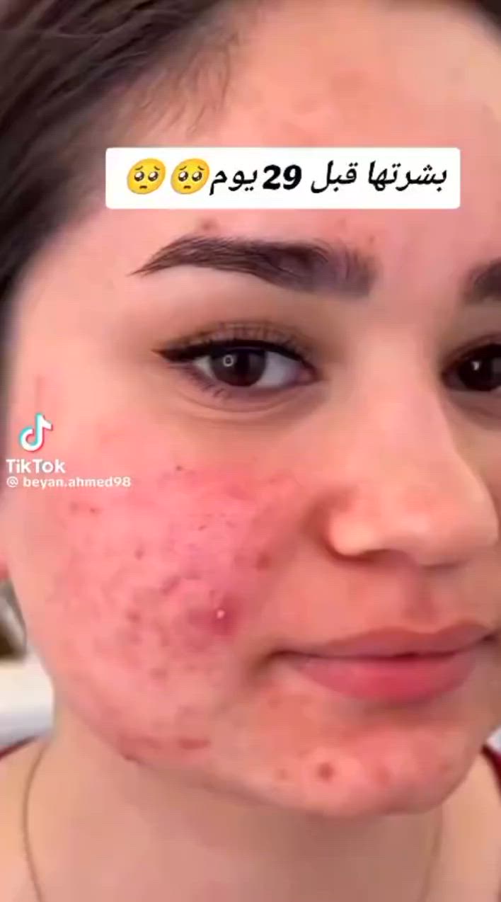 عندج كلف عندج حبوب بشرتج لكل انواع البشره وجميع المشاكل صابونه جانوزي العضويه من شركة DXNالعالميه الحل الامثل لجميع المشاكل مجربه ومضمونه


**إذا كنت صاحب هذا الإعلان وتريد حذفه لأي سبب، رجاءا أرسل رسالة إلى الدعم الفني**