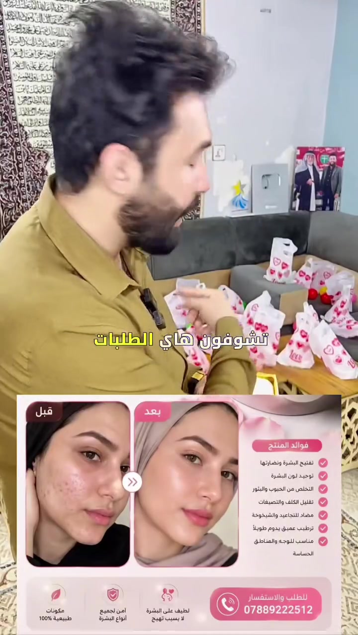 قسمًا بالله فرق واضح من أول استخدام وداعًا للحبوب ✨ الكلف ✨ التصبغات ✨  وشحوب البشرة -وكلشي مضر 
صابونة + دهن خبطة العناية من متجر بموشة ومنتجات الشاوي 💛
✅ تبييض ونضارة✅ توريد الوجه والمناطق الحساسة✅ شد البشرة وتقليل التجاعيد✅ ترطيب عميق ولمعة صحية✅ تخفيف آثار الحبوب والكلف✅ نتائج تلاحظها بنفسك
💯 مناسبة للبنات والشباب💯 مكونات آمنة ولطيفة على البشرة فرق من اول 3 ايام 
الك حق اترجعها اذا ماشتغلت بعد 7 ايام وتخابرنه وتدلل - اصلي فقط اصلي
📞 للحجز والاستفسار***********
الجمال يبدأ من العناية الصحيحة ✨ 
توضيح اكثر داخل الصور شوفو واقرو 👇 

#متجر_بمبوشة
#منتجات_الشاوي
