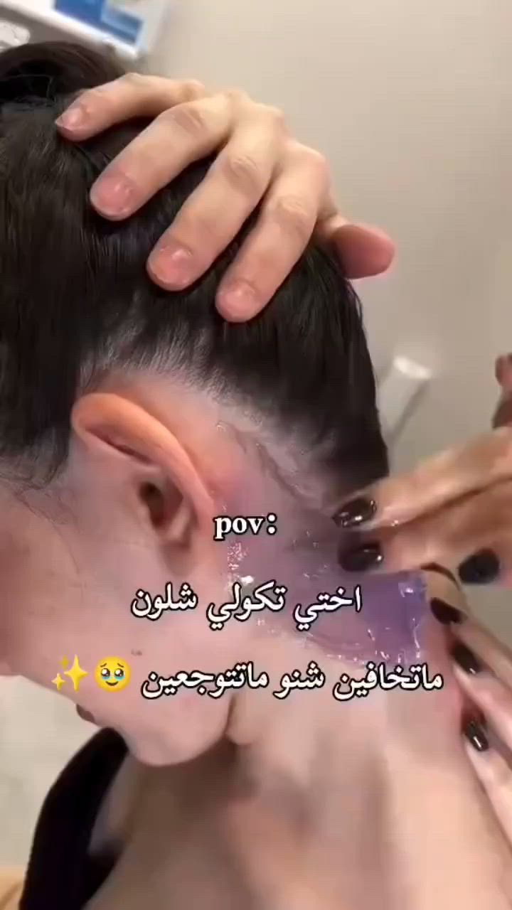 @للجميع
المخدر الكوري 
المخدر الكوري  الاصلي 100% 
اقوى مخدر 💪

وصلت اقوة وجبه 🤗
التركيز العالي 😊 نسبة تركيزه القويه 😍
وصول اقوه تركيز
يعني انسي شي اسمه الم 😍
مخدر موضعي لا ازالة الشعر من الجسم  والمناطق الحساسه  والتاتو والوشم 
مخدر كوري للتخدير  يستخدم لتخدير الجلد في حالة
استعمال ابر التاتو او الوشم.💋
والشفه💋 وازالة الشعر في 
الاماكن الحساسة
. 🤩يستعمل للوجه والجسم 🤩 

طريقة الاستعمال 👇👇
توضع كمية بسيطة منه على النطقة المراد ازالة الشعر منها وتغطى المنطقة لمدة ٤٠ دقيقة
بعد ذلك تزيلين الغطاء وتمسح المنطقة بمنديل ثم يتم ازالة الشعر او التاتو او الوشم بدون ألم 💯👍
#اقوى_جنة_الورد 
#اكسبلوا#مخدر#يجنن
#توصيل_لجميع_محافظات_العراق


**إذا كنت صاحب هذا الإعلان وتريد حذفه لأي سبب، رجاءا أرسل رسالة إلى الدعم الفني**