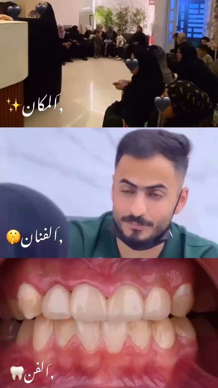 تستاهلون هيج فن 🦷✨
عيادة الدكتور أحمد الجنابي لطب الأسنان🦷😍
📍 بغداد – المحمودية
حي الموظفين – مجاور مول هبي دي
📍 بغداد – المنصور
(الرقم الوحيد للحجز والاستفسار اتصال واتساب):***********
متوفر نظام الاقساط
