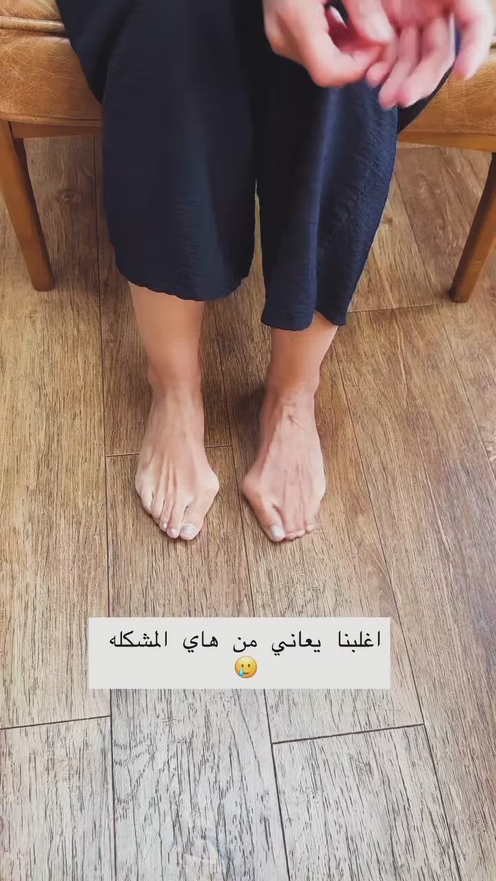 هل تعاني من بروز إصبع القدم أو الألم عند المشي؟

دعامة تصحيح الإبهام تساعدك ترجع الإصبع لوضعه الطبيعي تدريجياً 🔄

مع قفل ضبط يعطيك تحكم كامل بدرجة الشد 👌

خفيفة، مريحة، وتناسب كل المقاسات

مثالية للاستخدام أثناء النوم أو الراحة

تخفف الألم وتقلل احتكاك القدم بالحذاء

حل عملي وسريع للي يعانون من انحراف الإبهام

#صحة_القدم
#تقويم_الإبهام
#علاج_طبيعي
#بدون_جراحة
#منتجات_طبية
راحة_المشي
تخفيف_الألم


**إذا كنت صاحب هذا الإعلان وتريد حذفه لأي سبب، رجاءا أرسل رسالة إلى الدعم الفني**