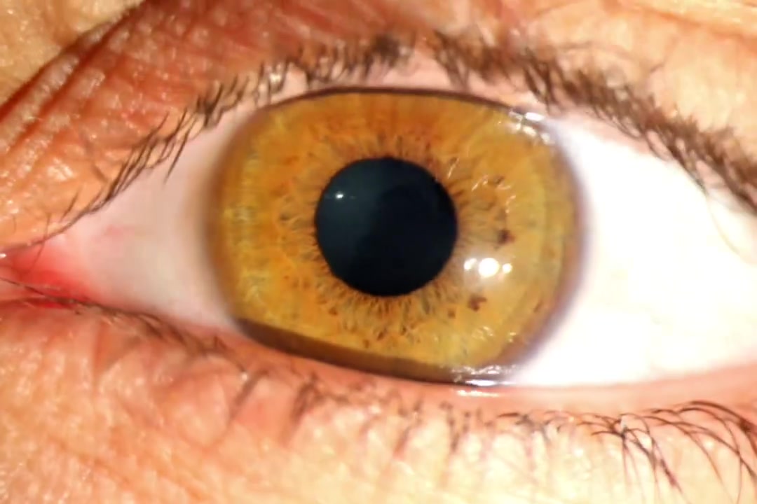 #رأرأة_العين #Torsional_Nystagmus

دوام العيادة جميع ايام الاسبوع من الساعة الرابعة عصرا الى الساعة الثامنه مساءا" عدا يومي الاحد والجمعة عطلة العيادة 🔴
___________________________________________
ونسأل الله الصحة والسلامة لجميع المرضى 

#الدكتور_حيدر_محمد_فياض_المعموري
عنوان العيادة : مجمع عماد الخير الطبي- مقابل مستشفى المسيب العام
للحجز والاستفسار: 
اتصال او واتساب على الرقم 📞  📱 ☎️ 
 ***********

 #المسيب #مسيب #بابل #صحة #طبيب_عيون
