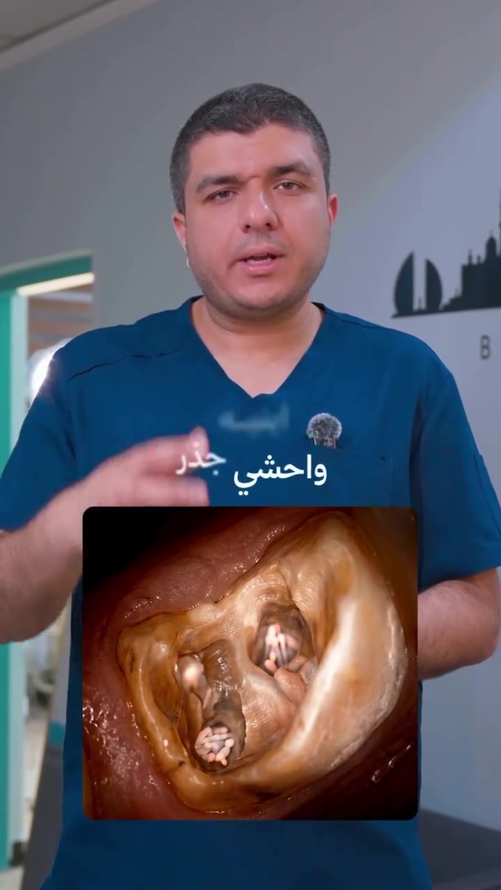 ⁨ ⁨ ⁨ ⁨ عيادة الحارثية لطب وتجميل الأسنان
نهتم بابتسامتك بأحدث التقنيات وبأعلى مستوى من الدقة والرعاية ✨
(زراعة اسنان المانية + تركيبات الزركون التجميلية)
فريق متخصص، نتائج مضمونة، وتجربة مريحة بكل تفاصيلها 🦷💛

📍 الحارثية – مقابل مطعم مون لايت
📞 ***********⁩⁩⁩⁩
